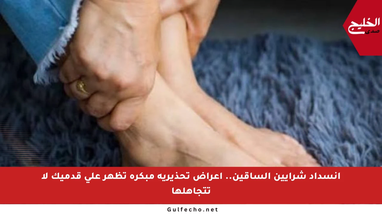 انسداد شرايين الساقين.. أعراض تحذيرية مبكرة تظهر على قدميك لا تتجاهلها